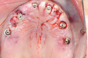 Dsc 0271 ggza3f - Eugenol