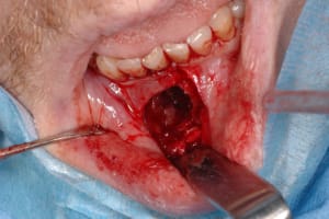 Dsc 0274 rgxjjw - Eugenol