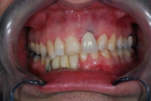 Dsc 0291 e7uwvt - Eugenol
