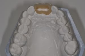 Dsc 0310 tnidts - Eugenol