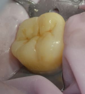Dsc 0748 e851qk - Eugenol