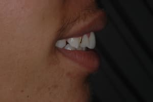 Dsc 0764 orl81n - Eugenol