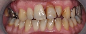 Dsc 0820 zupkro - Eugenol