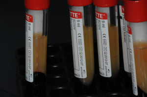 Dsc 1517 w9mr5x - Eugenol