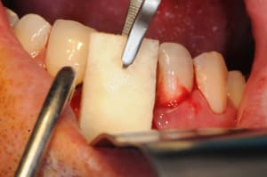 Dsc 1589 xl6zyu - Eugenol
