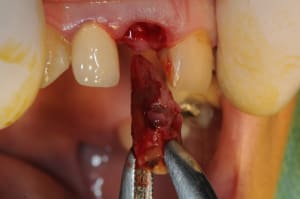 Dsc 1689 vt6zvh - Eugenol