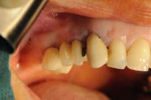 Dsc 2434 r2b4og - Eugenol