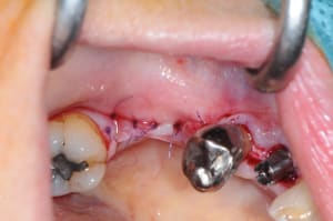 Dsc 2795 nsfqfx - Eugenol