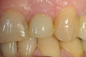 Dsc 3246 u6jder - Eugenol