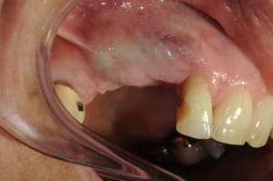 Dsc 3369 cjhknj - Eugenol