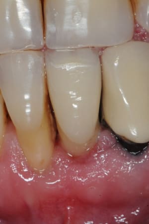 Dsc 3543 kwu2ti - Eugenol