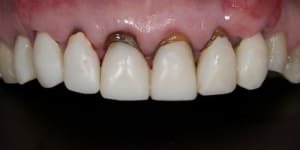 Dsc 3653 e5cffv - Eugenol