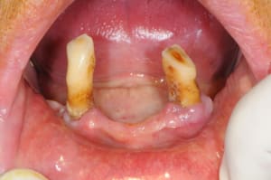 Dsc 3671 gvlcms - Eugenol