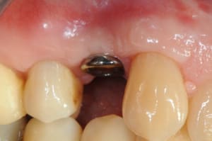 Dsc 3730 m2gptb - Eugenol