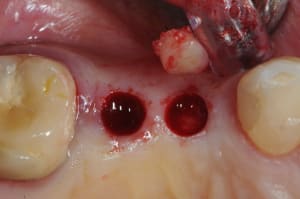 Dsc 4214 gesujq - Eugenol