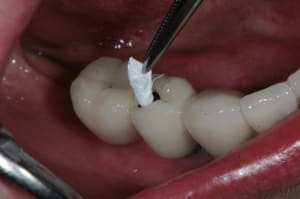 Dsc 4382 wmqlph - Eugenol