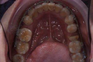 Dsc 4590 gt8dcu - Eugenol