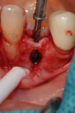 Dsc 5047 uniqvt - Eugenol