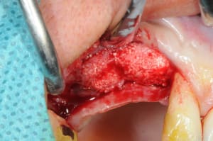 Dsc 5216 kzcs6n - Eugenol