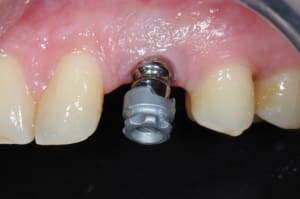 Dsc 5358 j318gd - Eugenol