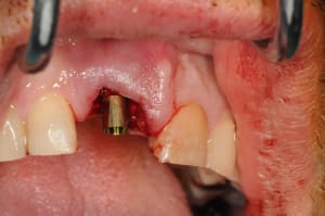 Dsc 5774 xynxlg - Eugenol