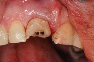 Dsc 5778 zziss0 - Eugenol