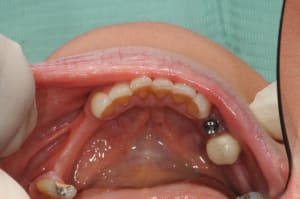 Dsc 6232 vmrgwv - Eugenol