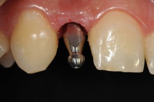 Dsc 6257 czt0k8 - Eugenol