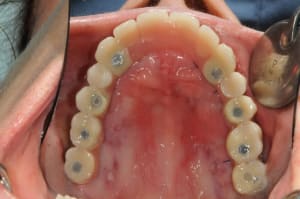 Dsc 6376 ajtron - Eugenol