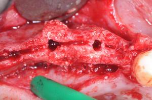 Dsc 7721 kwglkw - Eugenol