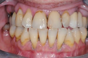 Dsc 7826 ggcwut - Eugenol