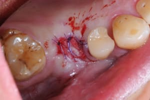 Dsc 8862 gjw6ow - Eugenol