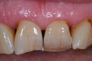 Dsc 9033 vfxolz - Eugenol