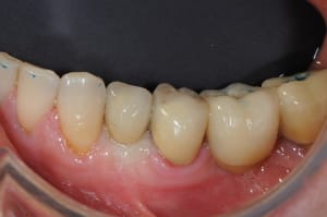 Dsc 9082 wnoi4e - Eugenol