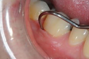Dsc 9431 tswtbf - Eugenol