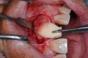 Dsc 9449 m2mkwb - Eugenol