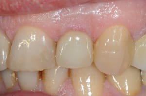 Dsc 9626 tuby7w - Eugenol