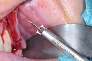 Dsc 9740 gochdx - Eugenol