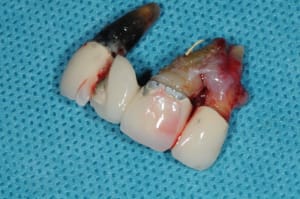 Dsc 9993 plpj4z - Eugenol