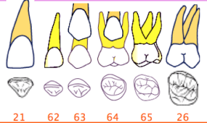 Dents de lait kdwv4k - Eugenol