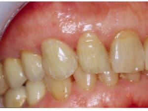 Diapositive4 xh5738 - Eugenol