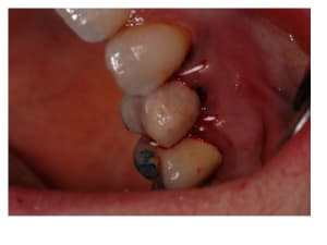 Diapositive6 jgxfk6 - Eugenol