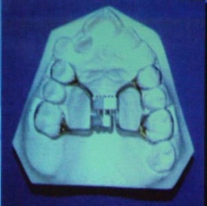 Dscf2087 1 i61scw - Eugenol