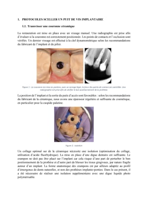 Extrait memoire sceller ou transvisse o2jkh5 - Eugenol