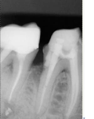 F3 laypse - Eugenol