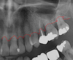 Fa elis05.04 - Eugenol