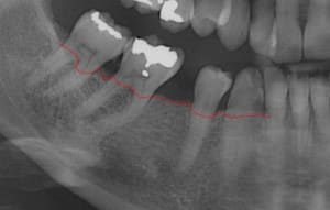 Fa elis05.04 - Eugenol