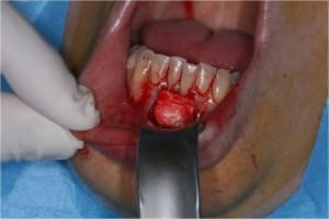 Gec3 kcp2yf - Eugenol