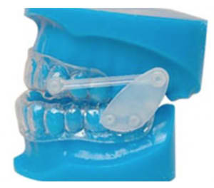 Goutti re ahzyer - Eugenol