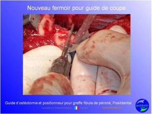 Guide d ost otomie  positionneur fibula positdental006 bpruas - Eugenol